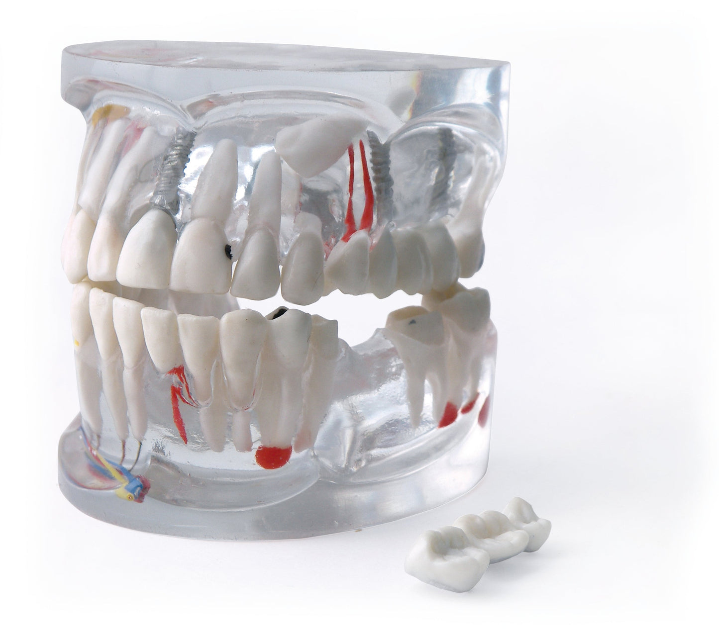 Mod. Transparente Ds0800 – Dentalstore