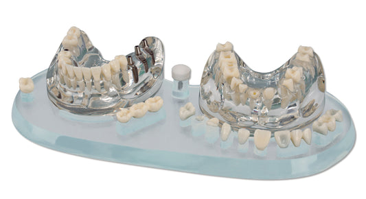 Mod. Estudio Implantes E Protesicos – Hager & Werken