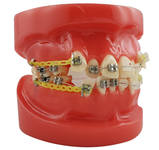 Mod. De Brackets – Dental Store