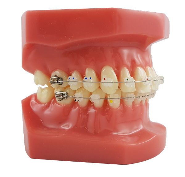 Mod. De Brackets – Dental Store