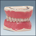 Mod. Pedodoncia 24 Denteencia Blanda – Dentalstore