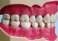 Mod. Universal 32 Dentes Gengiva Bland – Dental Store