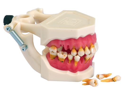 Mod. Parodontopatias – Dental Store