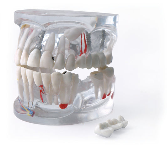 Mod. Transparente Ds0800 – Dentalstore
