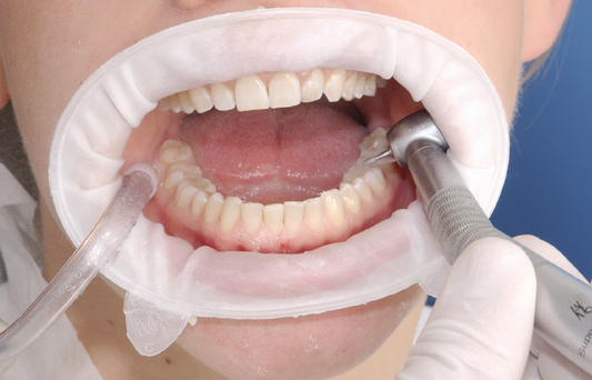 Retractores Optragate 80 Unid. - Ivoclar